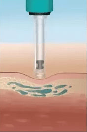 DERMOTECHNIKA - HYALURON PEN - daermes.com
